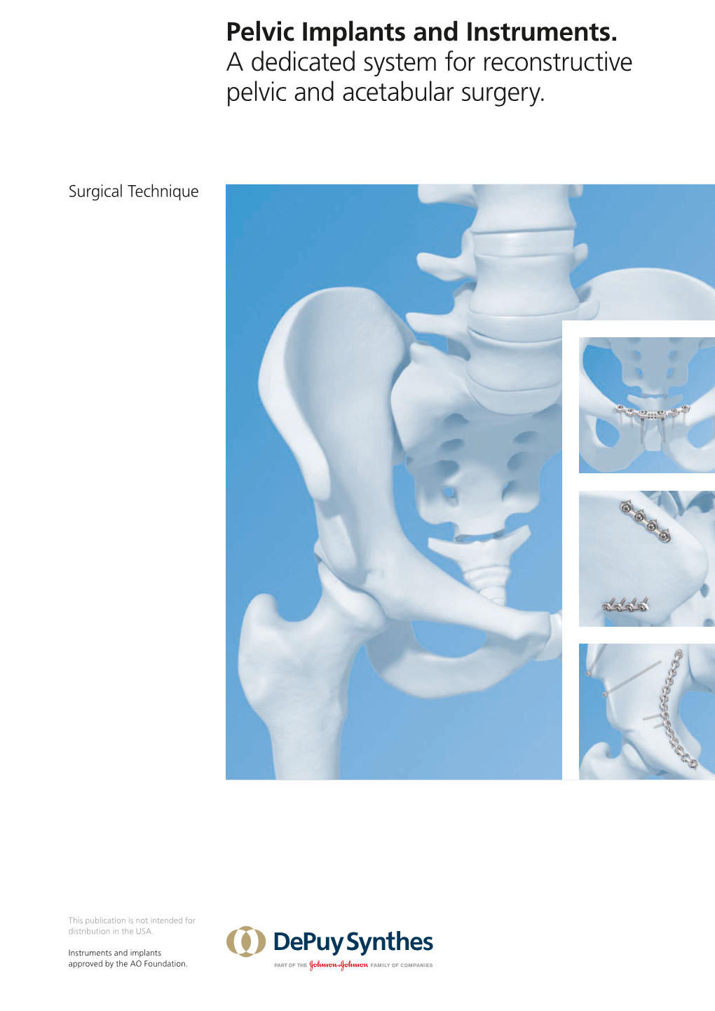 Pelvic Implants and Instruments. a Dedicated System for Reconstructive Pelvic and Acetabular Surgery