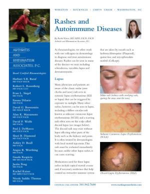 Rashes and Autoimmune Diseases