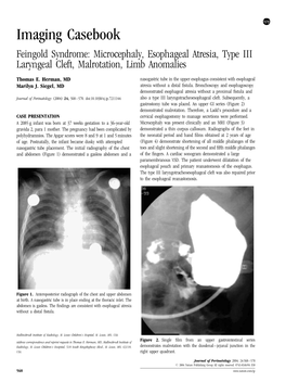 Imaging Casebook Feingold Syndrome: Microcephaly, Esophageal Atresia, Type III Laryngeal Cleft, Malrotation, Limb Anomalies