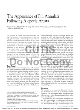 The Appearance of Pili Annulati Following Alopecia Areata