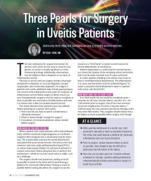 Three Pearls for Surgery in Uveitis Patients