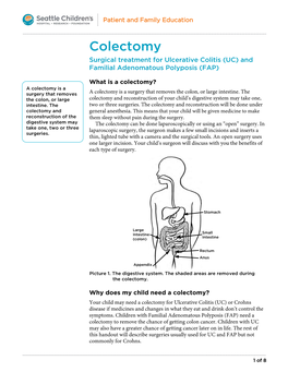 PE940 Colectomy