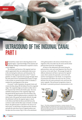 Ultrasound of the Inguinal Canal Part I