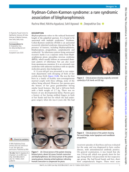 A Rare Syndromic Association of Blepharophimosis Rachna Meel, Nikitha Ayyadurai, Sahil Agrawal ‍ ‍ , Deepsekhar Das ‍ ‍