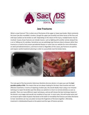 Jaw Fracture Repair