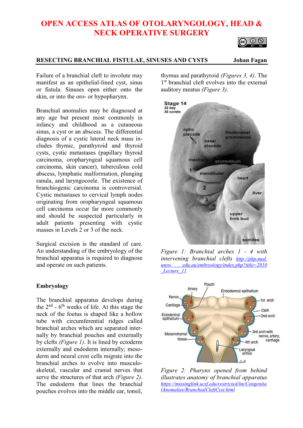 Resecting Branchial Cysts, Fistulae and Sinuses