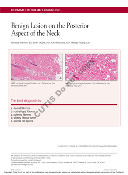Benign Lesion on the Posterior Aspect of the Neck