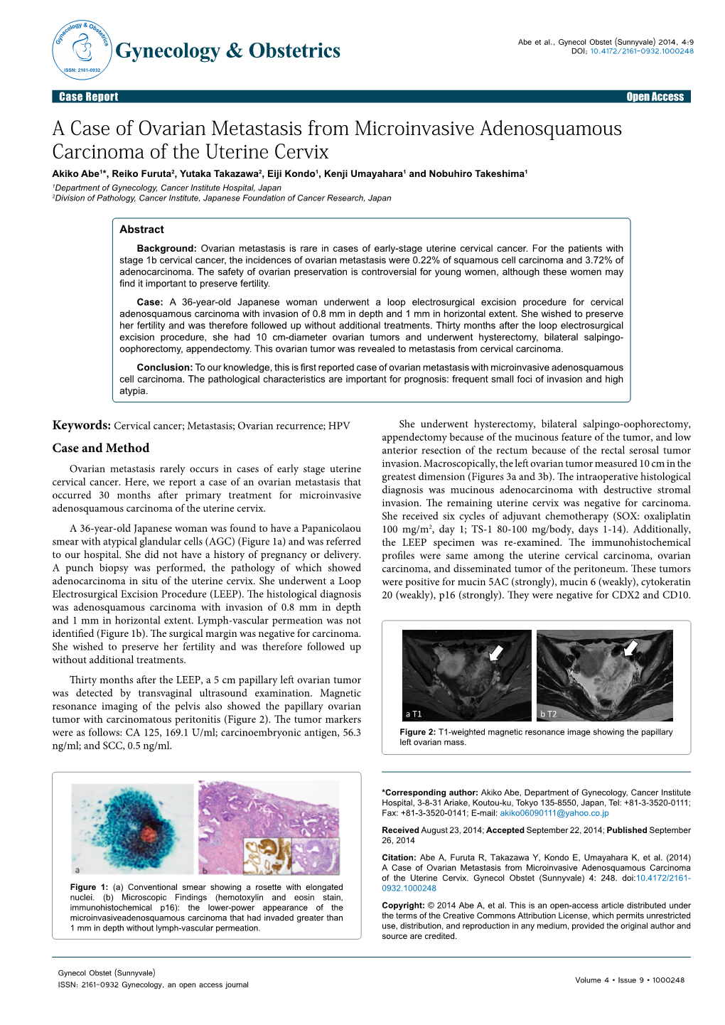 A Case of Ovarian Metastasis from Microinvasive Adenosquamous