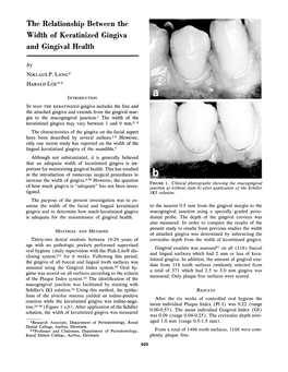 The Relationship Between the Width of Keratinized Gingiva and Gingival Health By