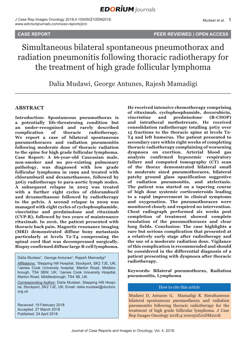 Simultaneous Bilateral Spontaneous Pneumothorax and Radiation Pneumonitis Following Thoracic Radiotherapy for the Treatment of High Grade Follicular Lymphoma