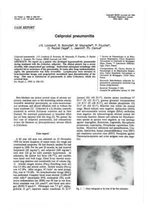 Celiprolol Pneumonitis