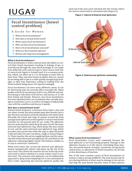 Fecal Incontinence (Bowel Control Problem) a Guide for Women