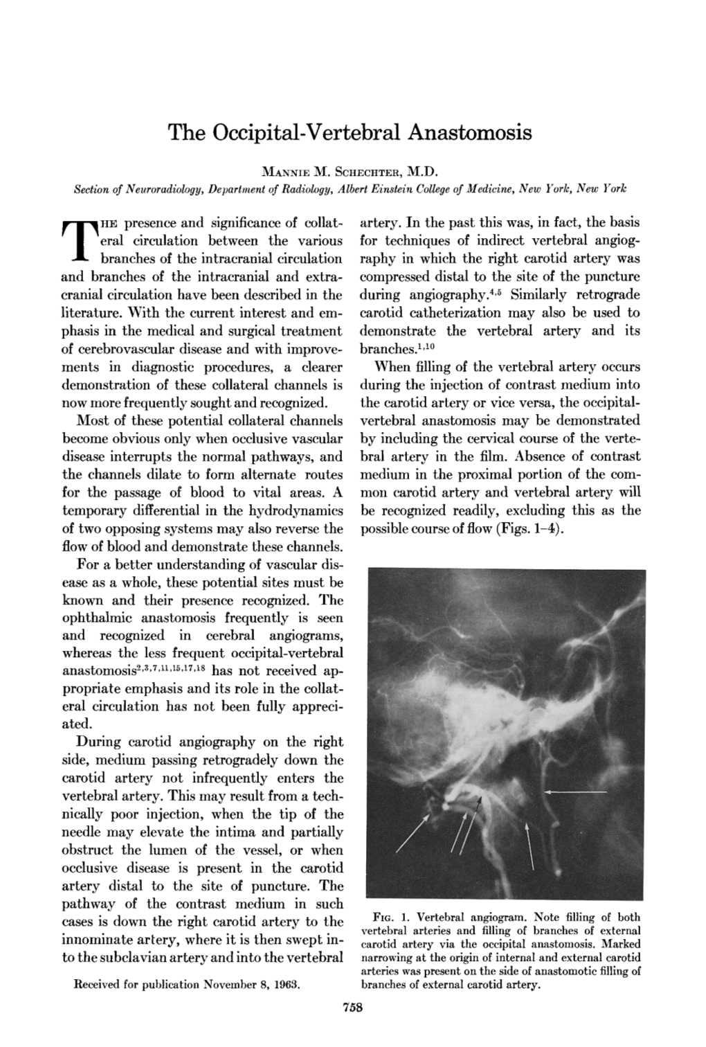 The 0Ccipital-Vertebral Anastomosis