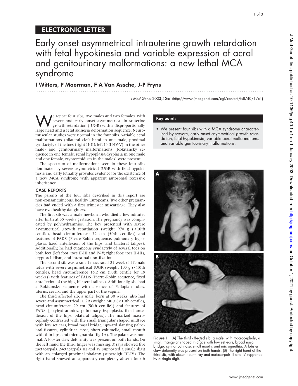 Early Onset Asymmetrical Intrauterine Growth Retardation with Fetal