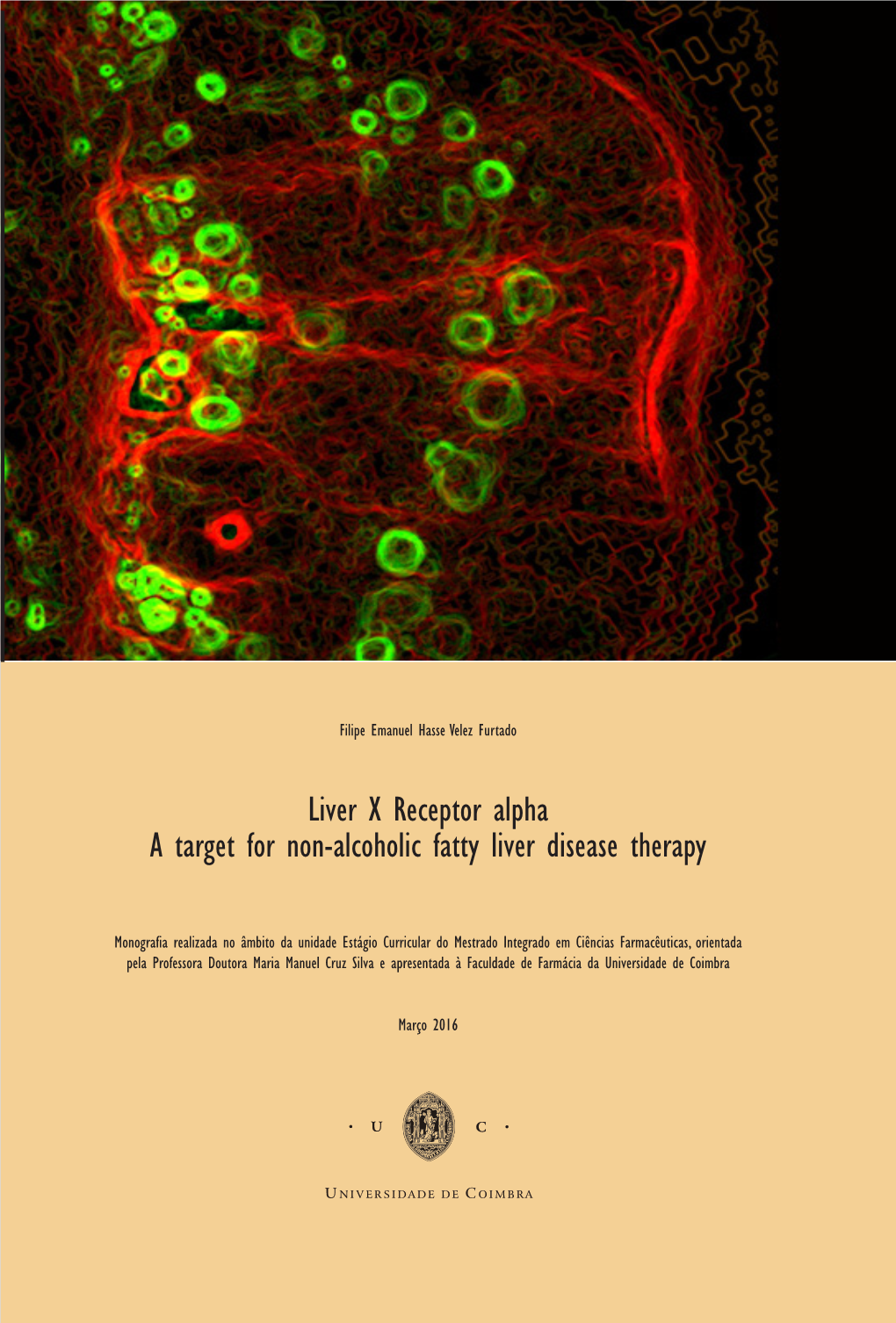 Liver X Receptor Alpha a Target for Non-Alcoholic Fatty Liver Disease Therapy