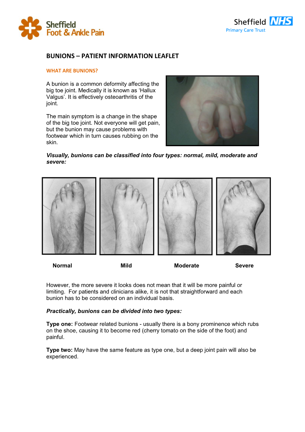 Bunions – Patient Information Leaflet