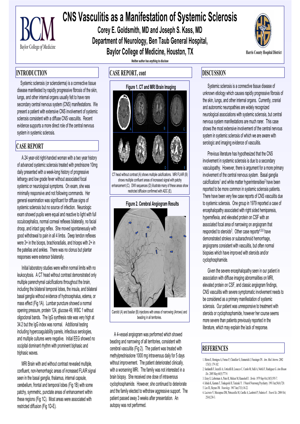 CNS Vasculitis As a Manifestation of Systemic Sclerosis Corey E