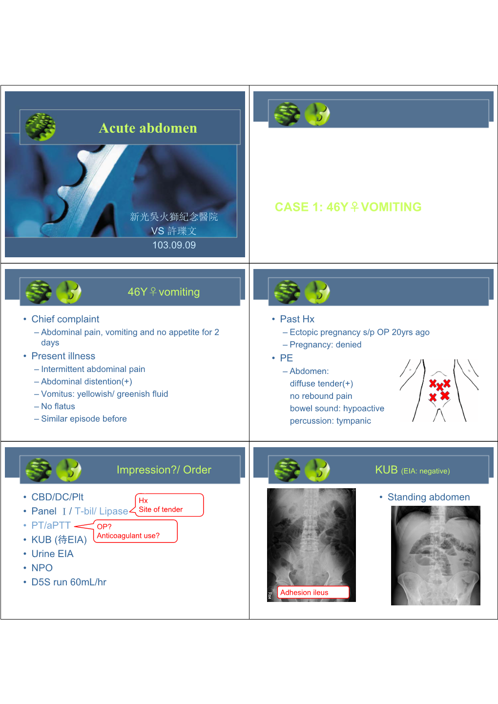 Acute Abdomen