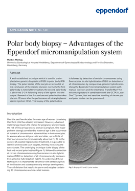 Polar Body Biopsy – Advantages of the Eppendorf Micromanipulation System