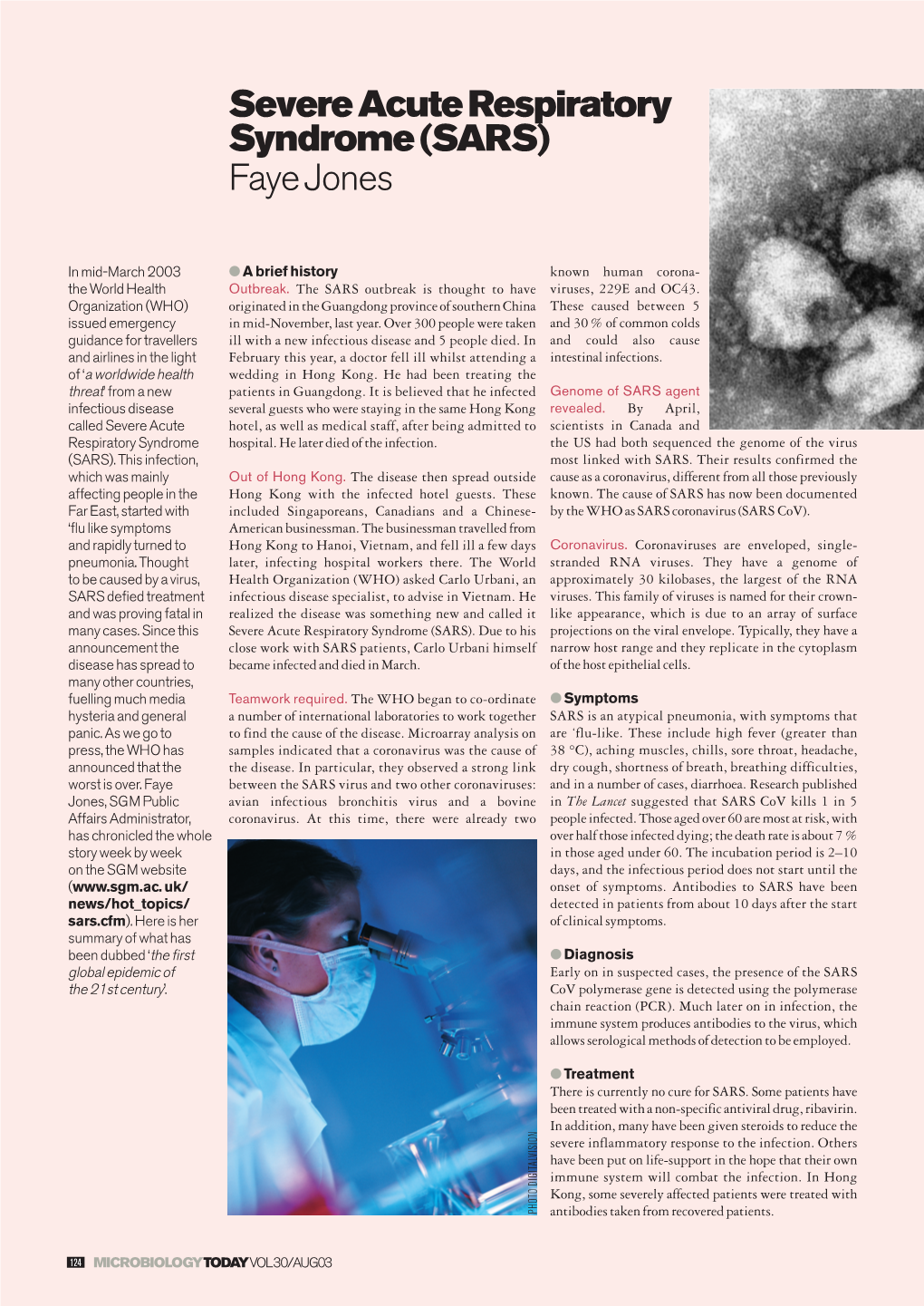 Severe Acute Respiratory Syndrome (SARS) Faye Jones