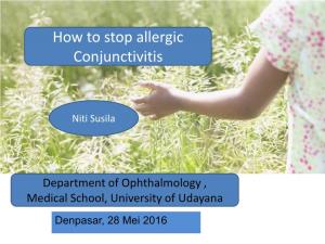 How to Stop Allergic Conjunctivitis