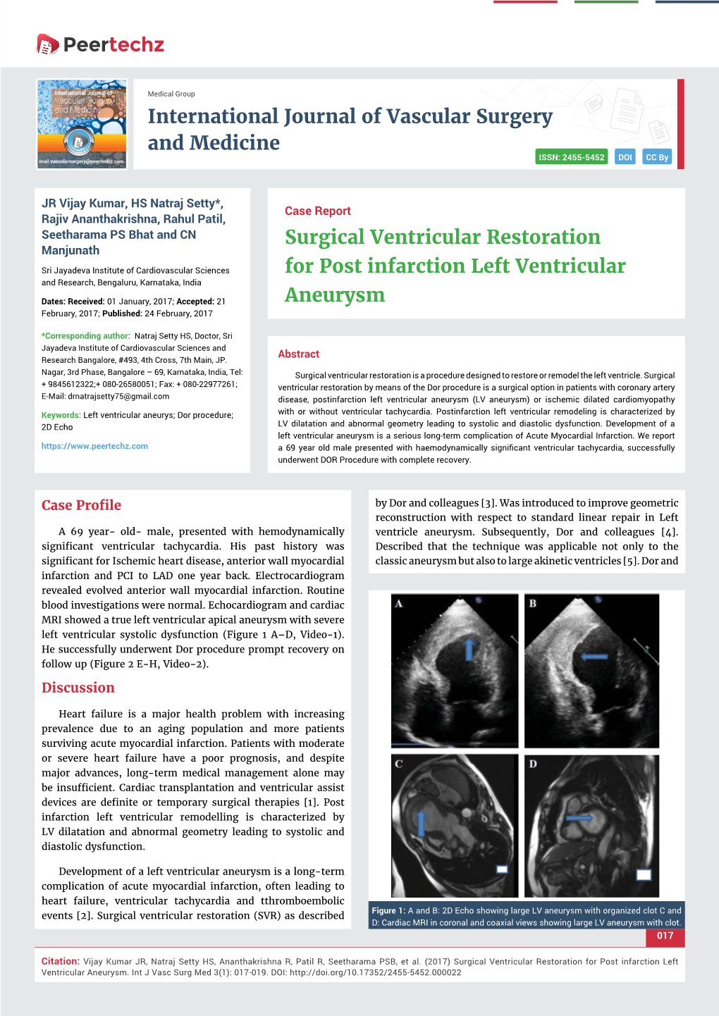 Surgical Ventricular Restoration for Post Infarction Left Ventricular Aneurysm