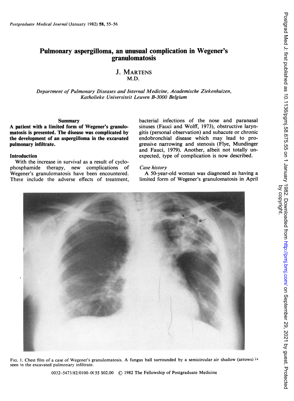 Pulmonary Aspergilloma, an Unusual Complication in Wegener's Granulomatosis J. MARTENS M.D