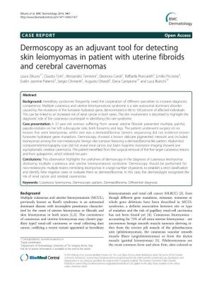 Dermoscopy As an Adjuvant Tool for Detecting Skin Leiomyomas In