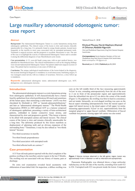 Large Maxillary Adenomatoid Odontogenic Tumor: Case Report