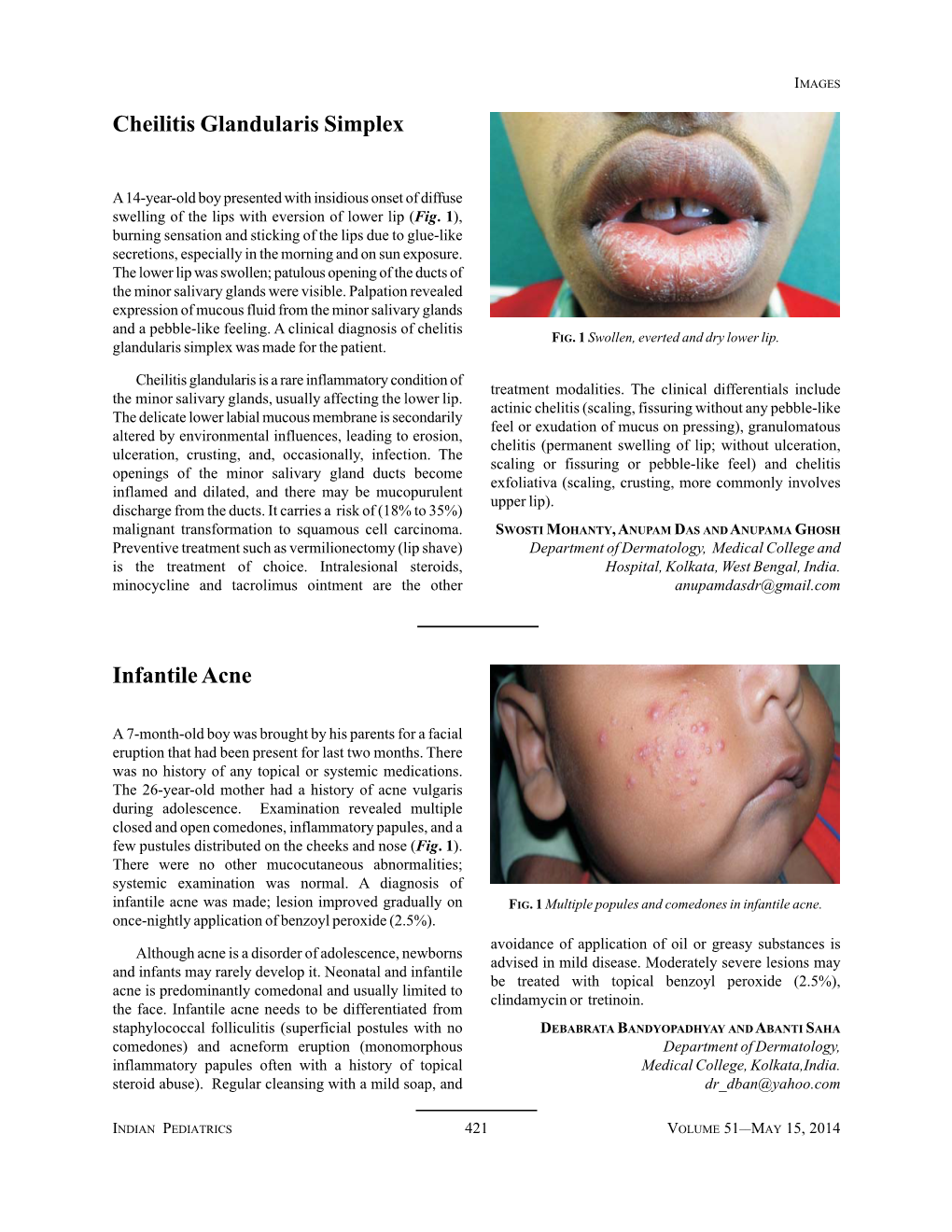 Cheilitis Glandularis Simplex Infantile Acne