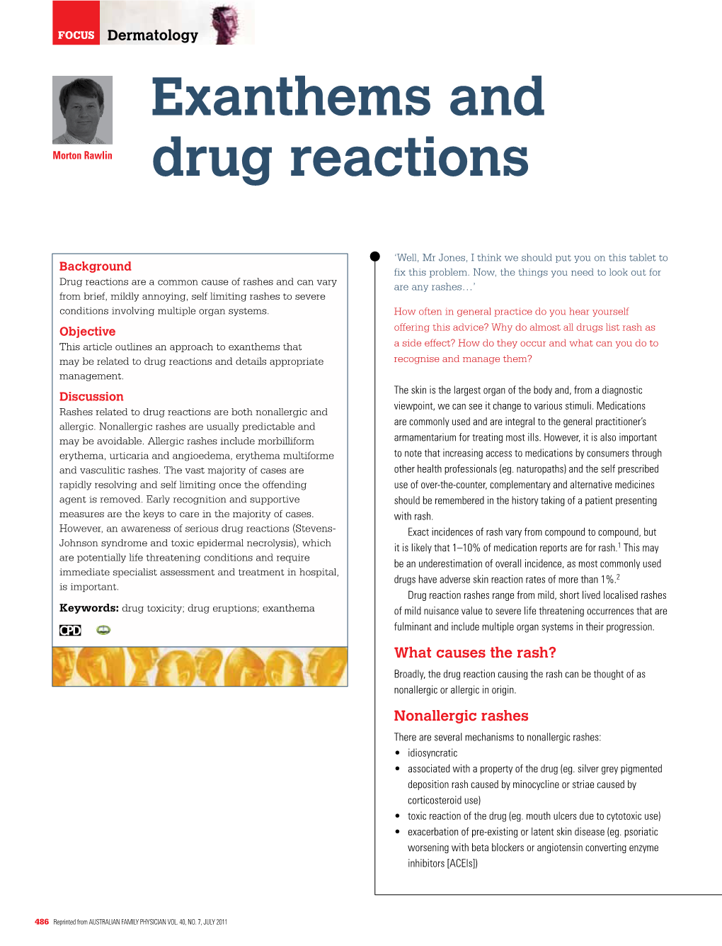 Exanthems and Drug Reactions