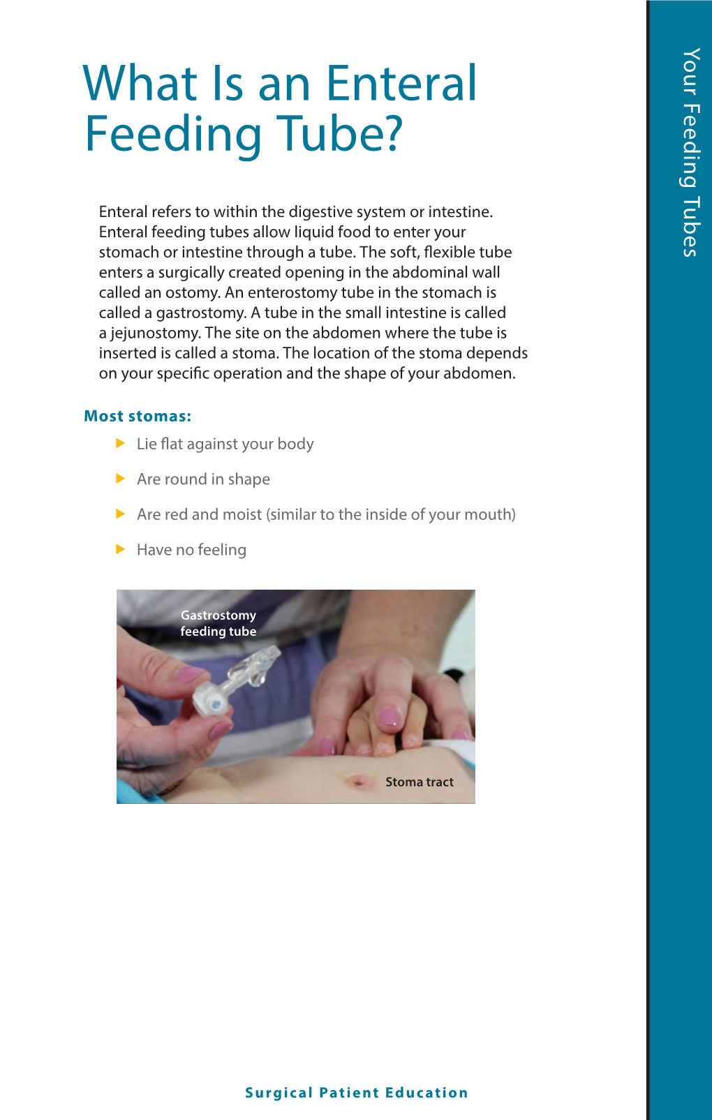 What Is an Enteral Feeding Tube?