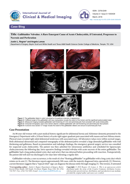 Gallbladder Volvulus: a Rare Emergent Cause of Acute Cholecystitis, If Untreated, Progresses to Necrosis and Perforation Justin L