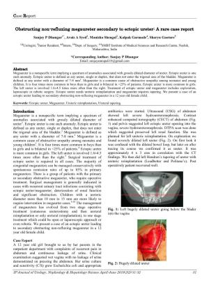 Obstructing Non-Refluxing Megaureter Secondary to Ectopic Ureter: a Rare Case Report