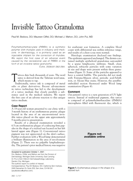 Invisible Tattoo Granuloma