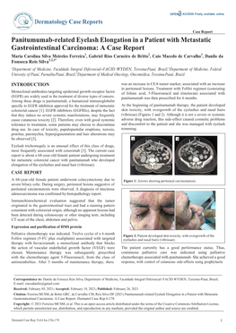 Panitumumab-Related Eyelash Elongation in a Patient With