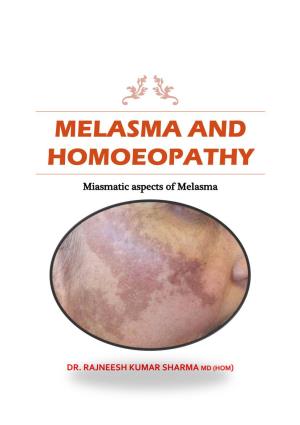 Melasma and Homoeopathy
