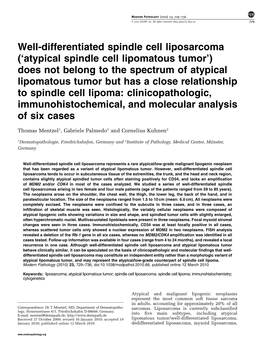 Well-Differentiated Spindle Cell Liposarcoma