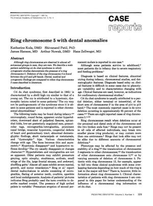 Ring Chromosome 5 with Dental Anomalies
