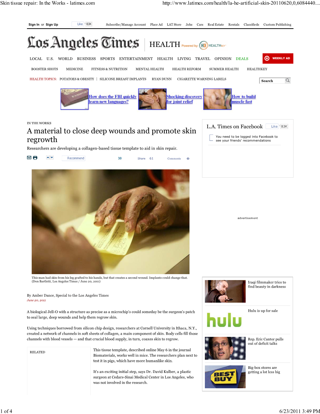 Skin Tissue Repair: in the Works - Latimes.Com