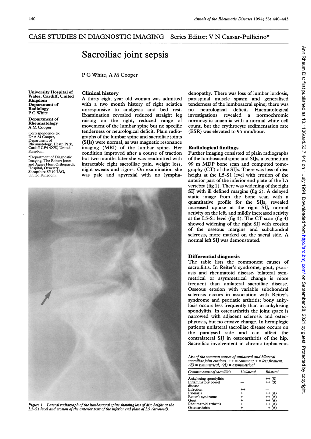 Sacroiliac Oint Sepsis