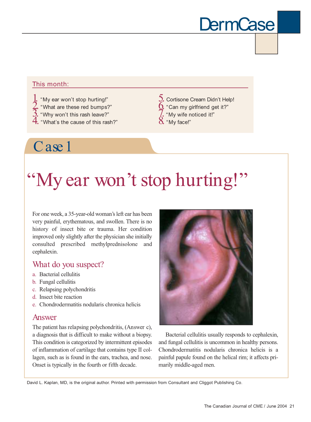 “My Ear Won't Stop Hurting!”