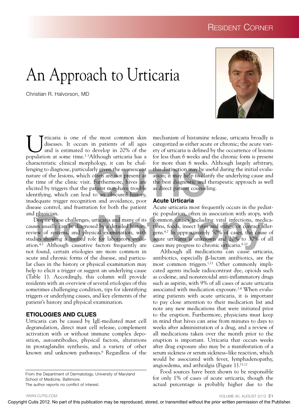 An Approach to Urticaria