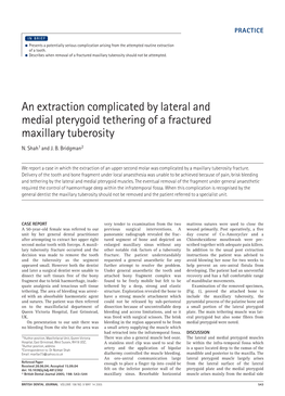 An Extraction Complicated by Lateral and Medial Pterygoid Tethering of a Fractured Maxillary Tuberosity