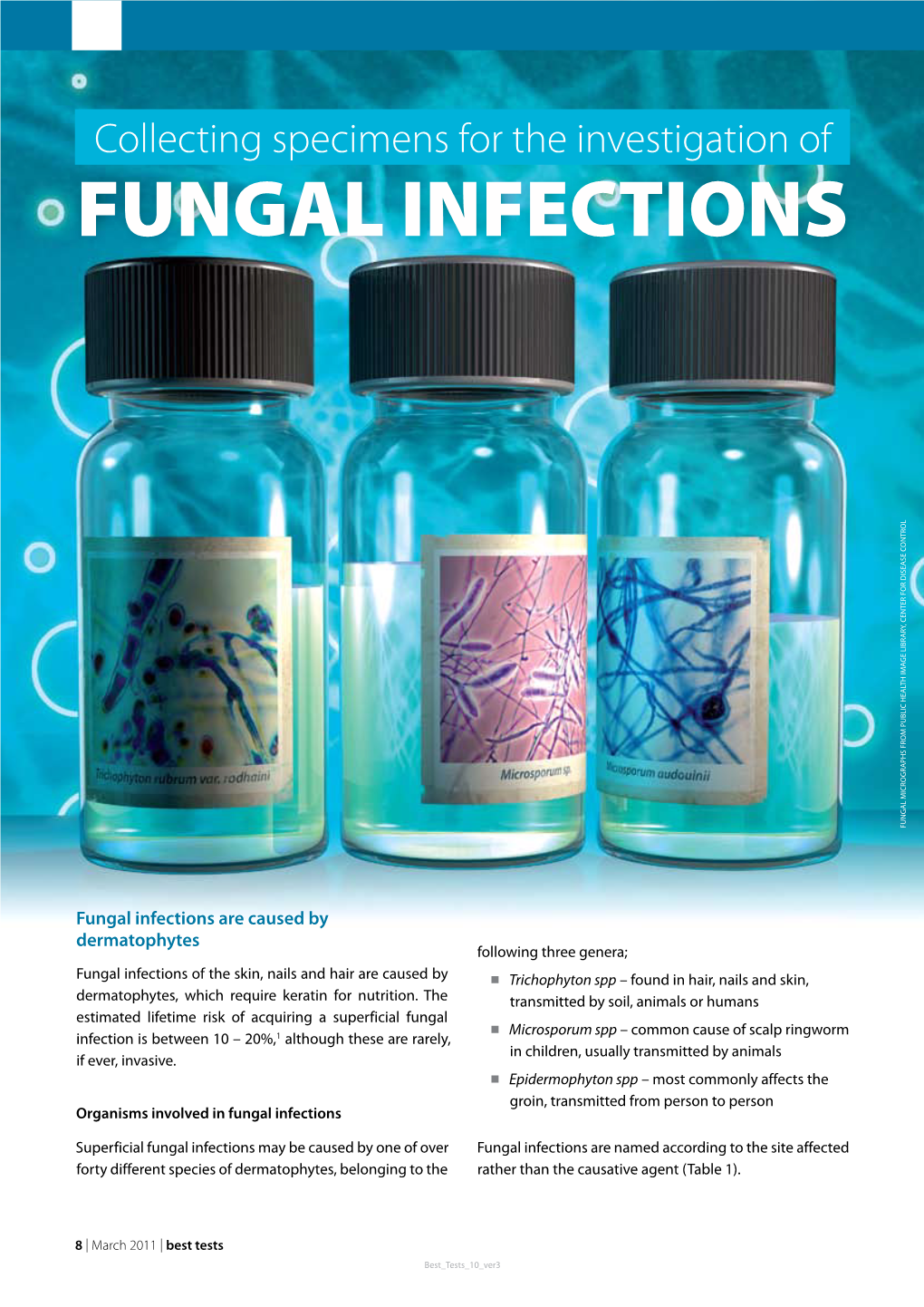 Fungal Infections Fungal Micrographs From Public Health Image Library 