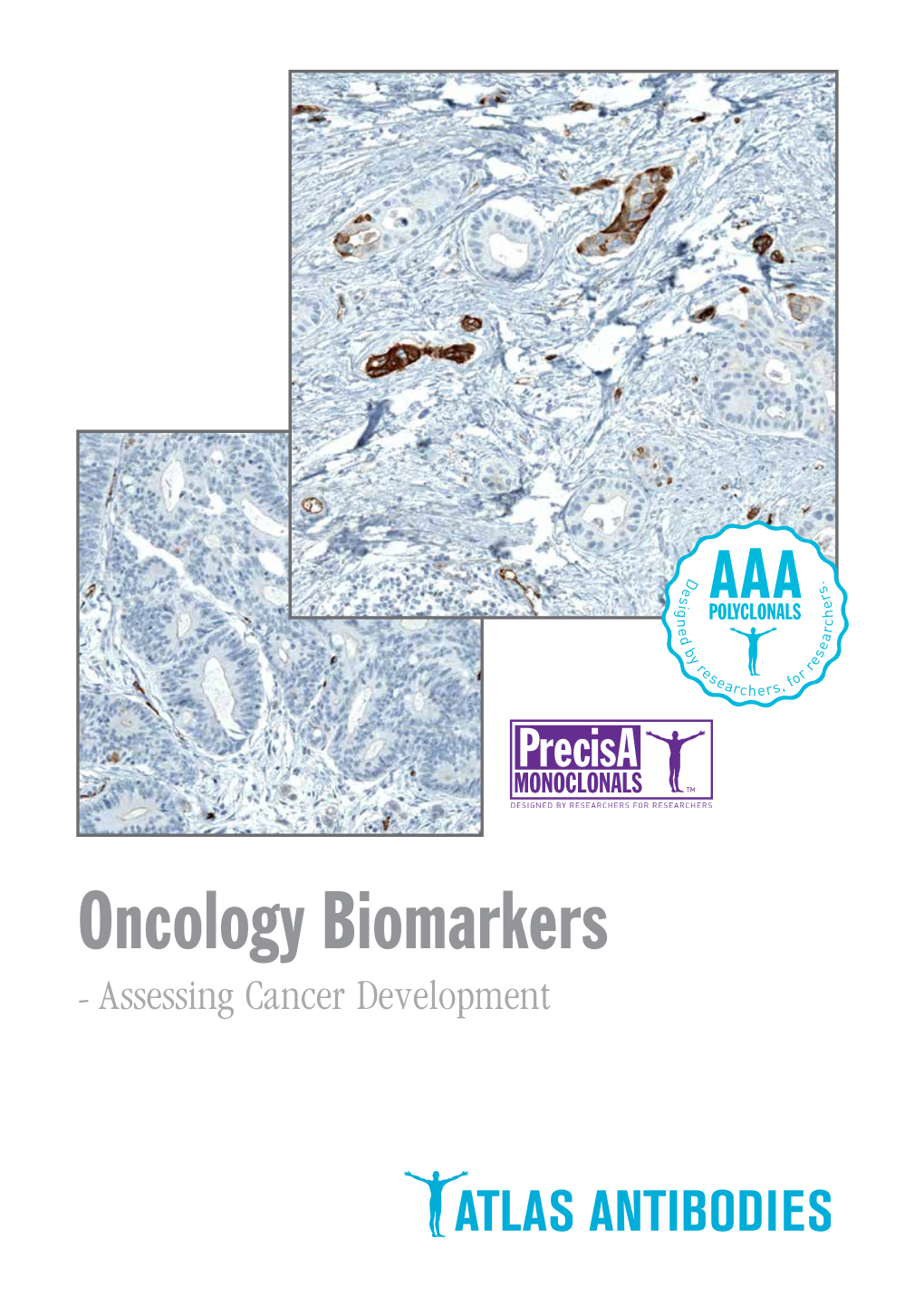 Oncology Biomarkers - Assessing Cancer Development Oncology Biomarkers