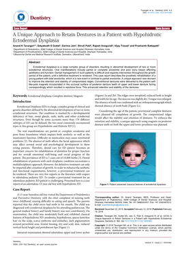 A Unique Approach to Retain Dentures in a Patient with Hypohidrotic Ectodermal Dysplasia