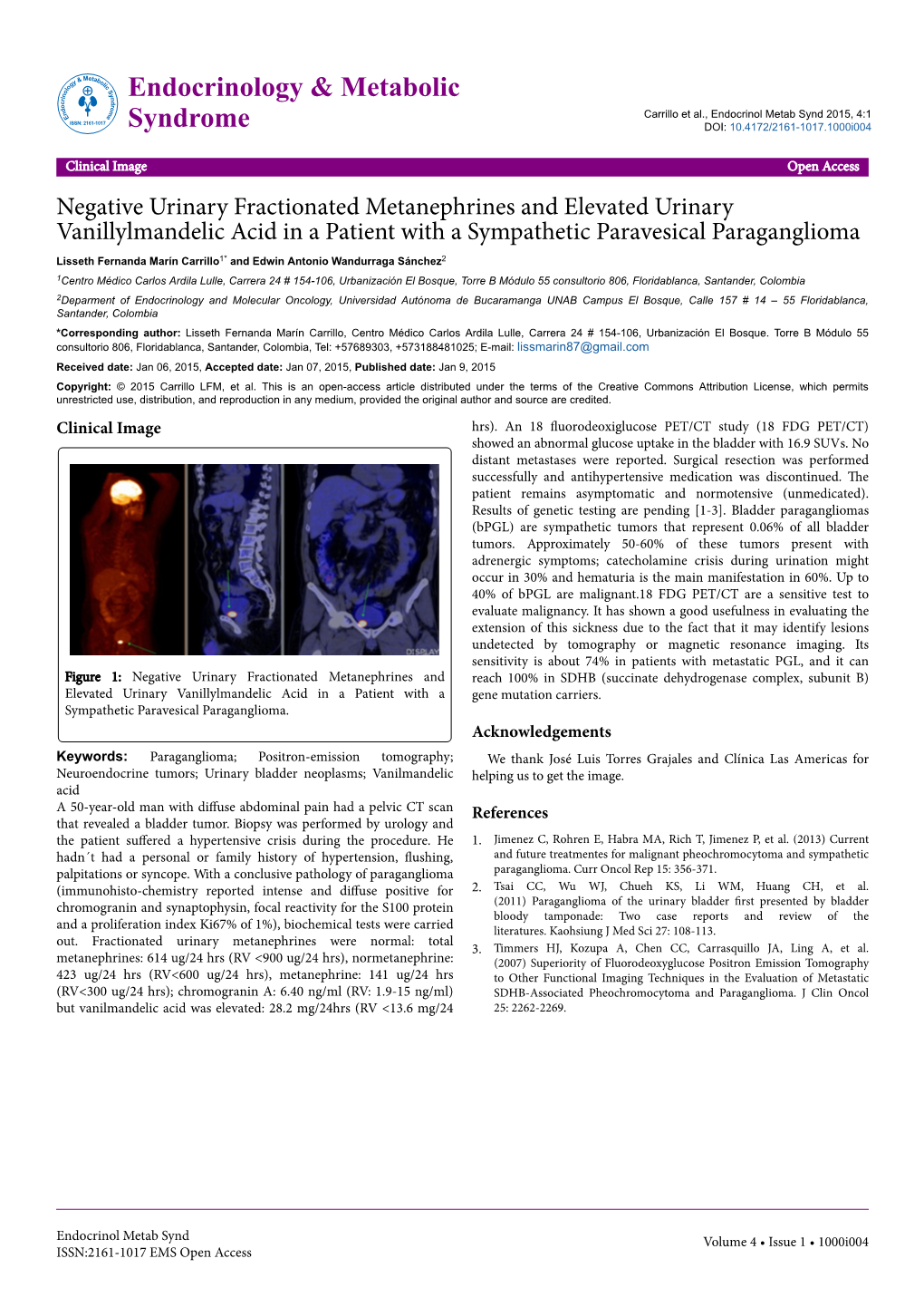 Negative Urinary Fractionated Metanephrines and Elevated