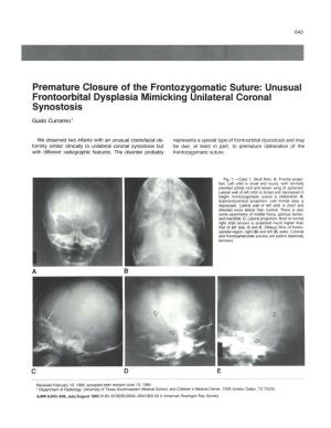 Premature Closure of the Frontozygomatic Suture: Unusual Frontoorbital Dysplasia Mimicking Unilateral Coronal Synostosis
