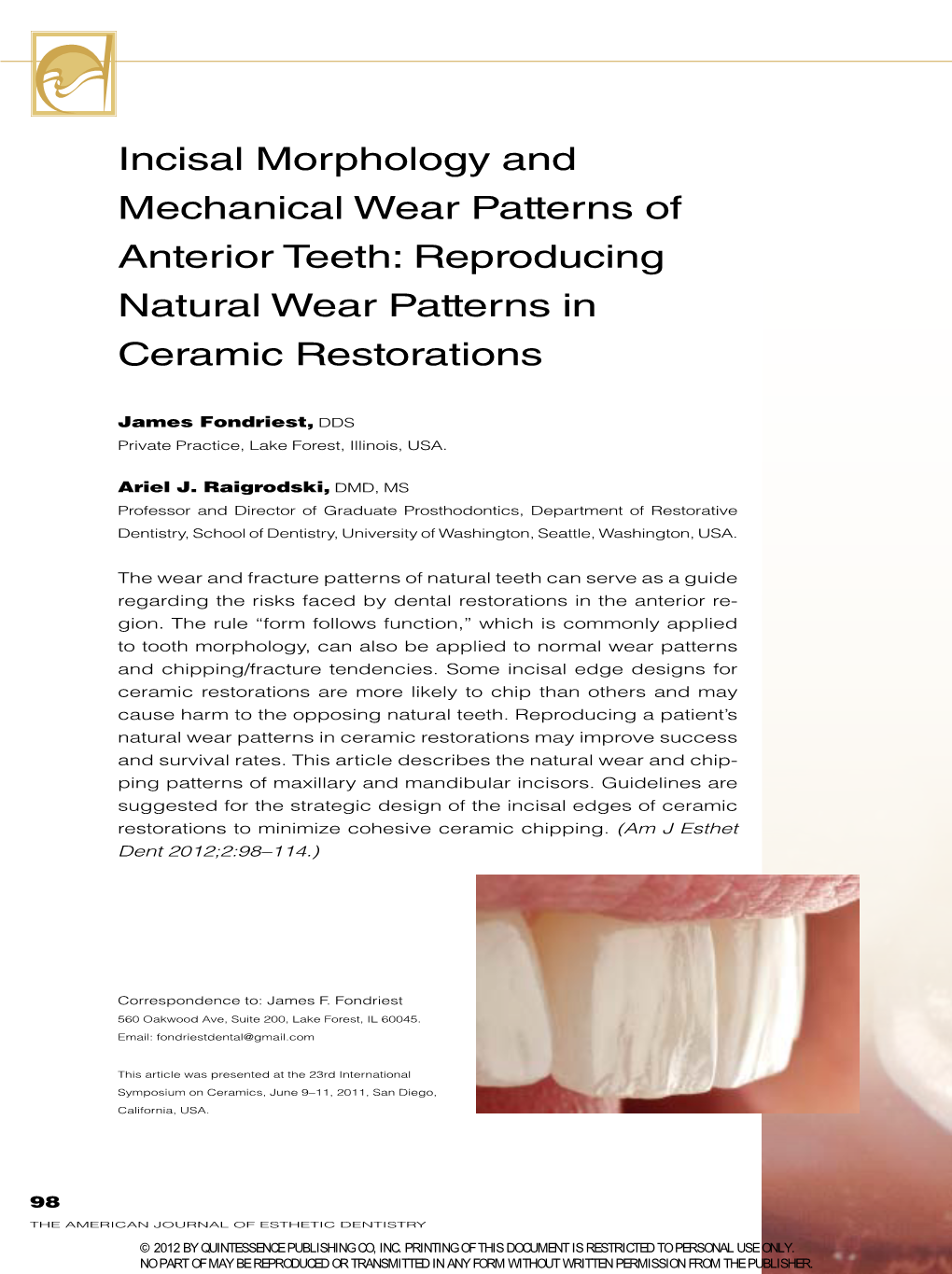 Incisal Morphology and Mechanical Wear Patterns of Anterior Teeth: Reproducing Natural Wear Patterns in Ceramic Restorations